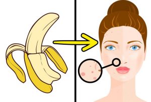 banana use to remove scar